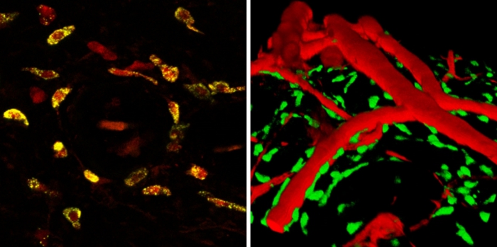 mast cells_collage mast cells_collage