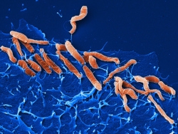 Helicobacter_pylori_klein